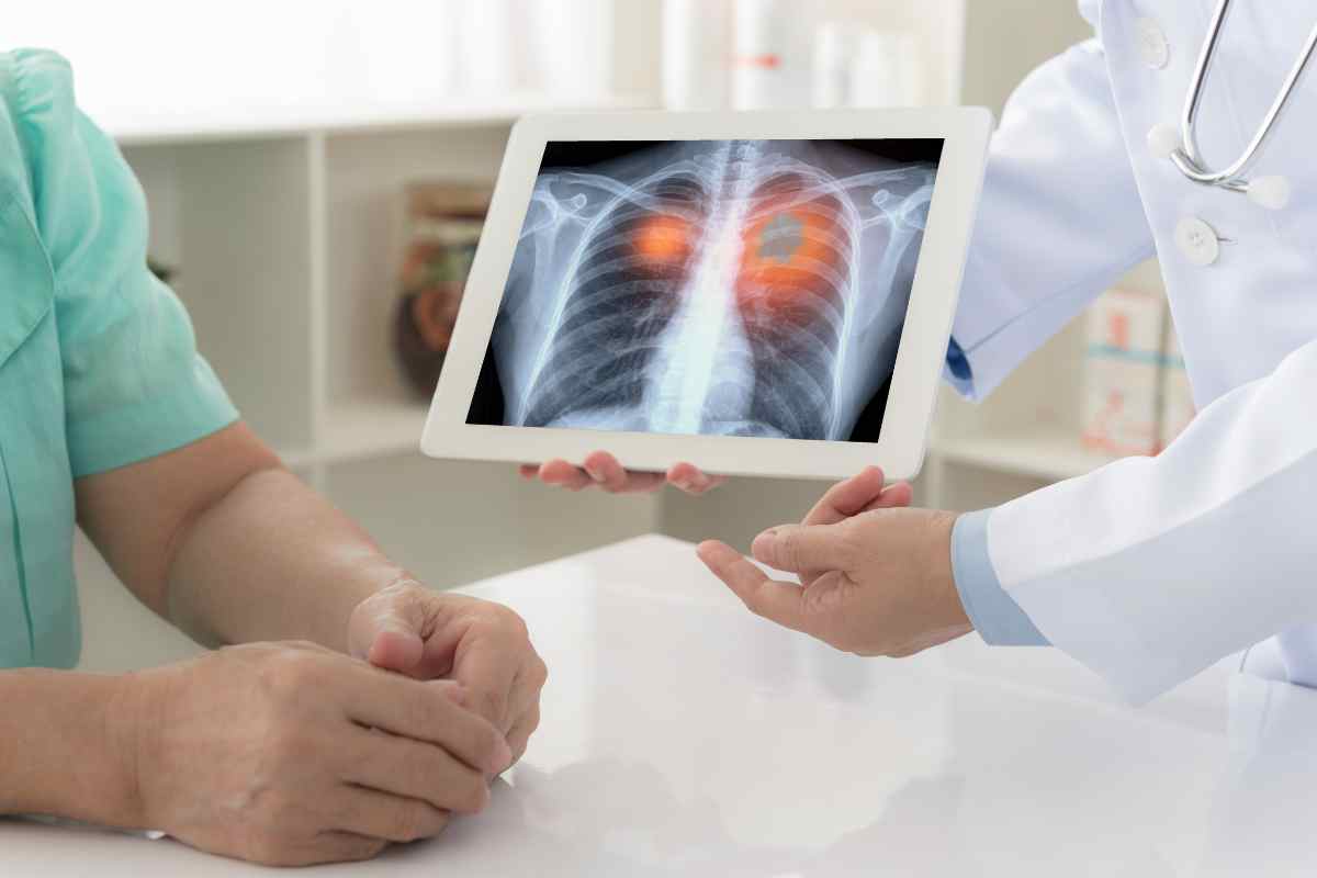 What Is Lung Cancer